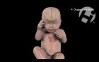 Transmission of Bacteria and Complications