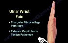 Causes of the Wrist Pain - Video Lecture