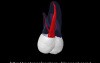 Maxillary Second Molar