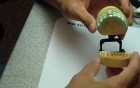 Triple Tray Dual Arch Impression