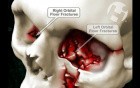 Volumated Skull