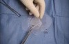 Inguinal hernia repair