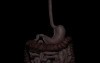 Laparoscopic bariatric procedures