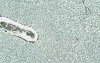 Liver Reticulin Fibers - Histology