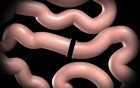 Duodenal Switch Animation