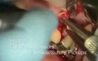 Periodontal Endoscopy And Microsurgery: Implant Repair
