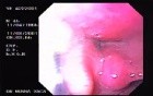 Oropharinx of a professional singer (1 of 2)