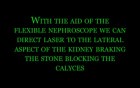 Percutaneous Nephrolithotripsy - Cystinuria