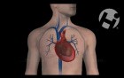 Pericardiocentesis