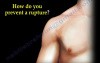 Pectoralis Muscle - Tendon Tear 