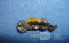 Dental Prothesis Found in the Jejuno (6 of 9)