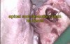 Endodontic surgery under the microscope