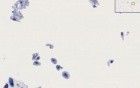 Atrophy - Histopathology - Cervix