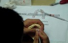 Anterior Waxup Correction - Part 1