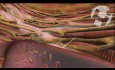 Coronary Perfusion