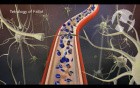 Damage from Tetralogy of Fallot Defects