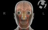 Cranial Nerve Function