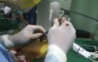 Percutaneous Nephrolithotomy - kidney stones removal