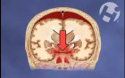 Brain Bleed Leading to Vision Impairment