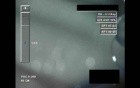 Cataract Surgery X - Part 4
