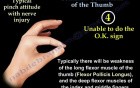 Common Conditions Of The Thumb 