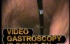 Gastroscopy