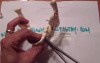 Mandible Fracture - Ivy Loop Fixation - Mandible Practice
