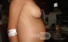 Gastric Cancer (9 of 15)