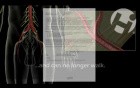 Result of Aortic Aneurysm Operation