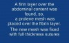 Mesh replacement in incisional hernia repair