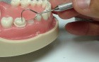 3/4 crown 3 unit FDP Prep