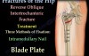 Hip Fractures and Fixation