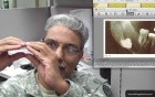 In.Saini - Dentigerous Cyst Formation