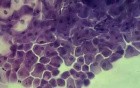 Cervix - Cytological examination