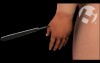 Treatment of Necrotizing Fasciitis
