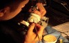 Diagnostic Waxup Part 8