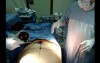 Tummy tuck surgery - body contouring