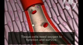Normal and Occluded Blood Flow