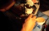 Diagnostic Waxup Part 6