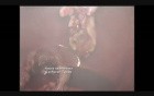 Ovarian cyst