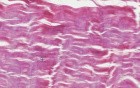 Dense Regular Connective Tissue - Histology