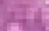 Lingual Tonsil - Histology