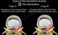 Disc herniation of the lumbo sacral spine