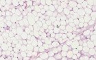 Adipose Tissue - Histology