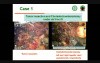 Hilar Cholangiocarcinoma Treatment With Surgical Robot