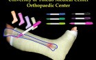 The Working Bones - Fractured Leg