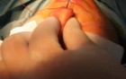 Tip rotation after hump removal