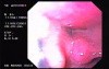 Oropharinx of a professional singer (1 of 2)