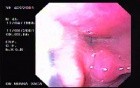 Oropharinx of a professional singer (1 of 2)