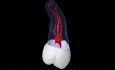 Maxillary Third Molar - Root Canal Anatomy